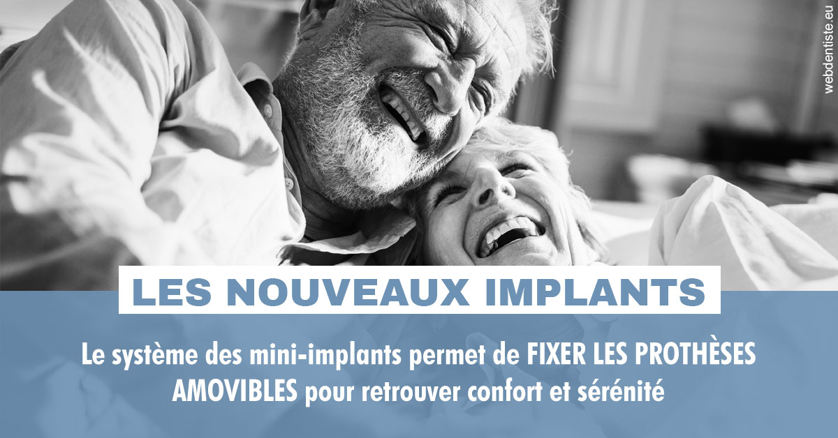 https://www.dr-deck.fr/Les nouveaux implants 2