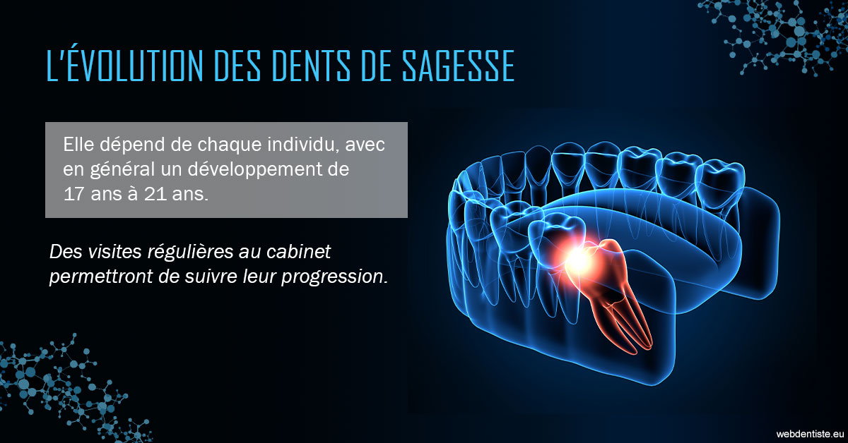 https://www.dr-deck.fr/2023 T4 - Dents de sagesse 01