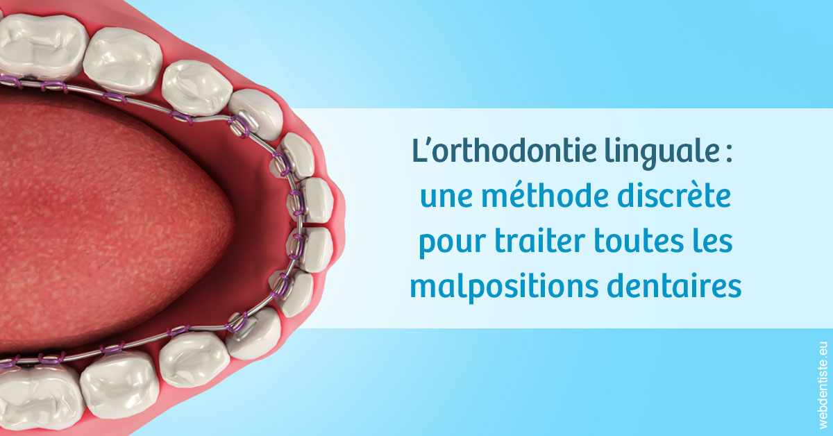 https://www.dr-deck.fr/L'orthodontie linguale 1