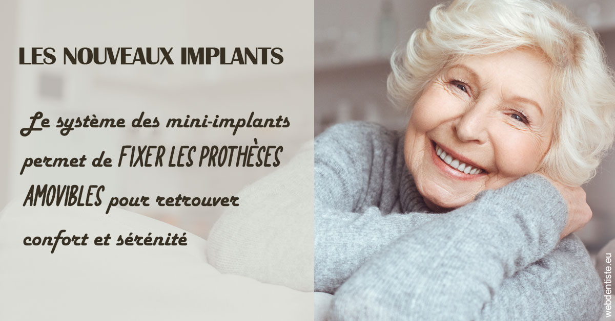 https://www.dr-deck.fr/Les nouveaux implants 1