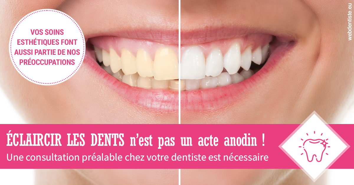 https://www.dr-deck.fr/2024 T1 - Eclaircir les dents 01