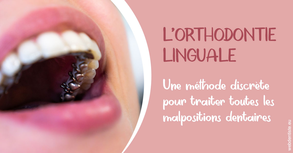https://www.dr-deck.fr/L'orthodontie linguale 2