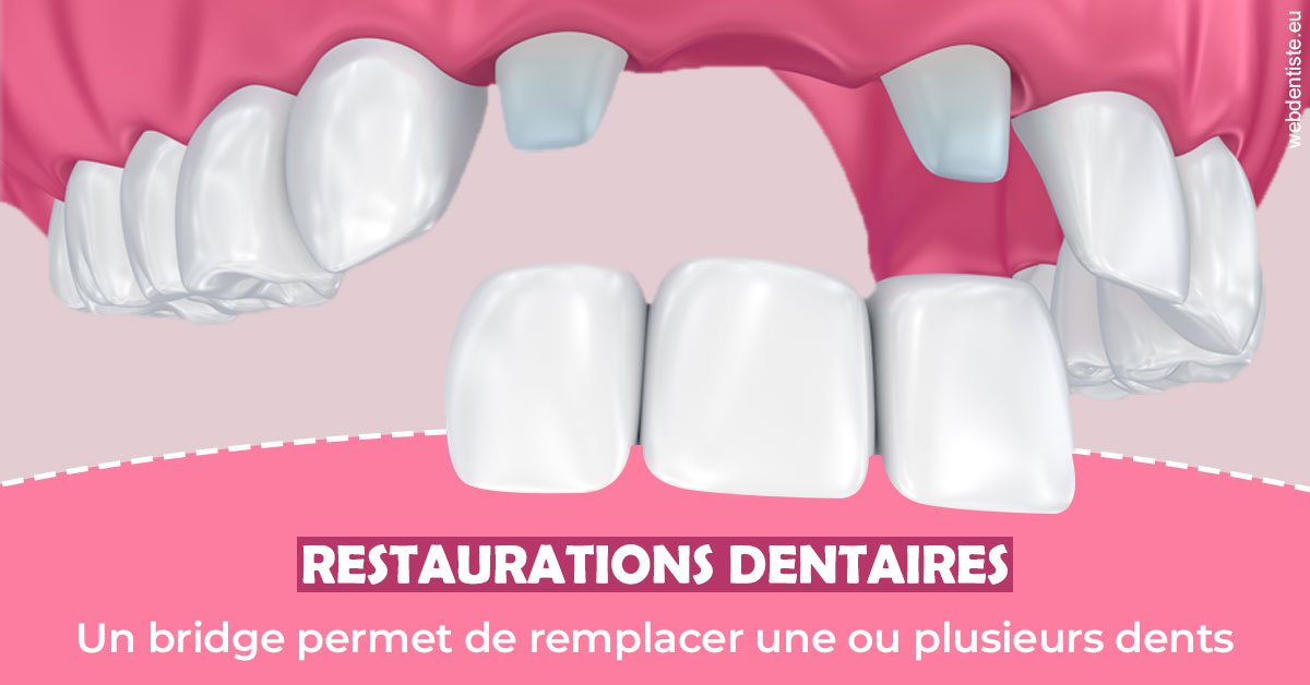 https://www.dr-deck.fr/Bridge remplacer dents 2