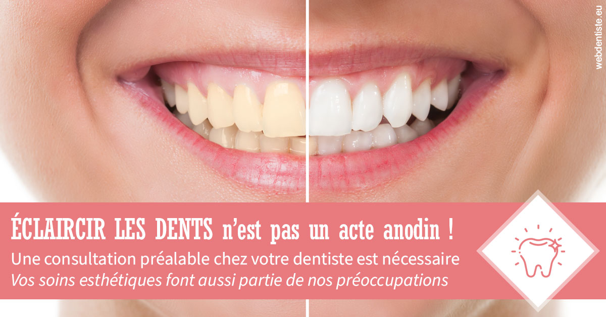 https://www.dr-deck.fr/Eclaircir les dents 1