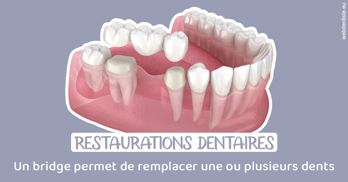 https://www.dr-deck.fr/Bridge remplacer dents 1