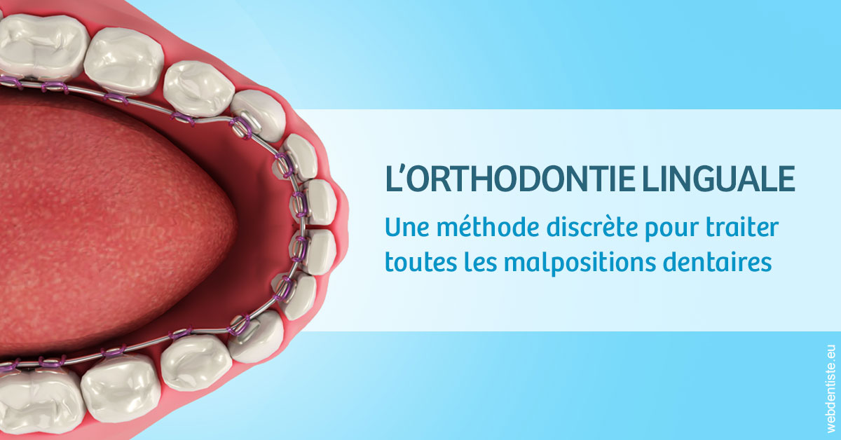 https://www.dr-deck.fr/L'orthodontie linguale 1