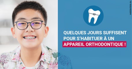 https://www.dr-deck.fr/L'appareil orthodontique