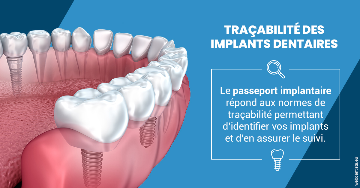 https://www.dr-deck.fr/T2 2023 - Traçabilité des implants 1