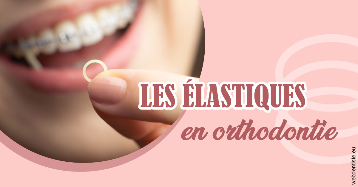 https://www.dr-deck.fr/Elastiques orthodontie 1