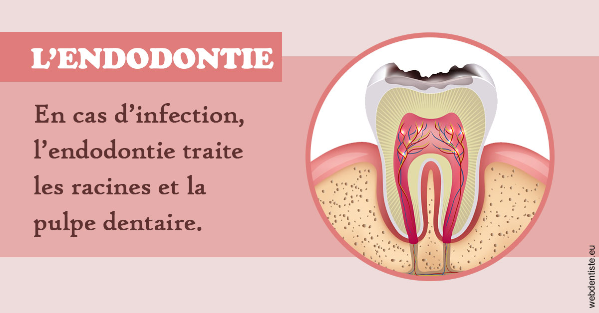 https://www.dr-deck.fr/L'endodontie 2