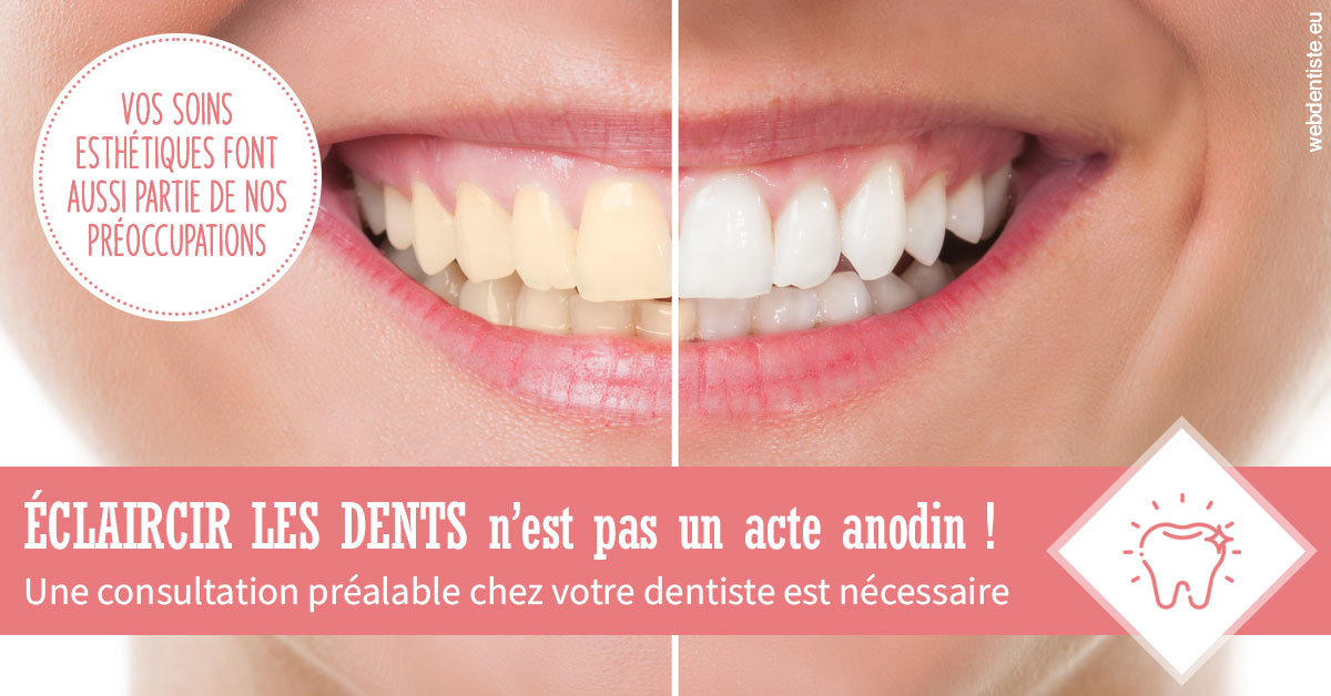 https://www.dr-deck.fr/Eclaircir les dents 1