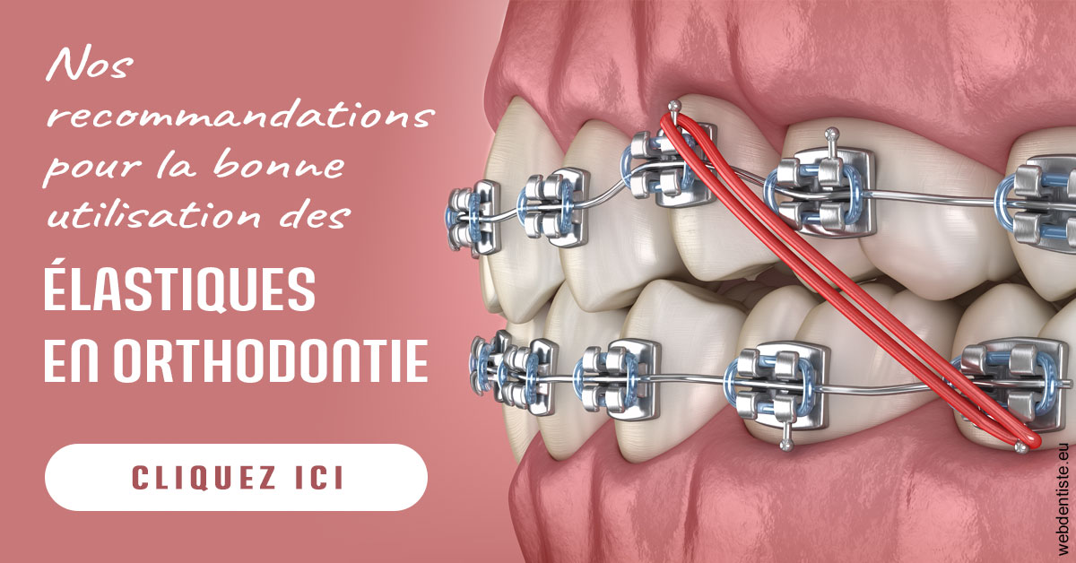 https://www.dr-deck.fr/Elastiques orthodontie 2