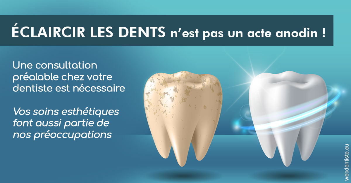 https://www.dr-deck.fr/2024 T1 - Eclaircir les dents 02